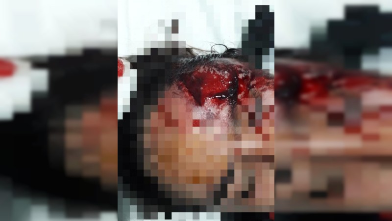 Zitácuaro: mujer se resiste a que le quiten su celular y es golpeada y apuñalada 